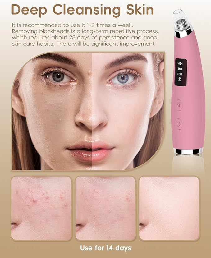 Blackhead Remover Pore Vacuum - Blackhead Remover for Face with 5 Attachments & 3 Suction Levels - Blackhead Vacuum removers for Women & Men (Matte Pink)