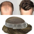 FACE MIRACLE Mens Toupee Lace Front Hairpieces Soft Human Hair Replacement System Natural Hairline Toupee for Men French Lace Poly V-Looped Mens hair Units 8"X10" 5#MEDIUM LIGHT BROWN