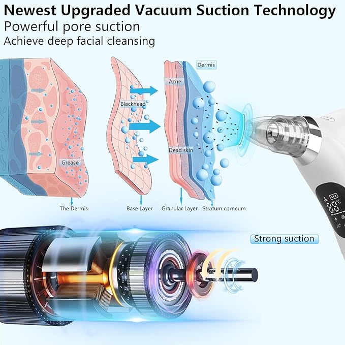 SJIE Blackhead Remover Vacuum Face Suction Pore Cleaner with Hot&Cold Compress Positive&Negative Ion Massage Nose Whitehead Remover Pimple Sucker with 5 Probes Pore Extractor Tool… (White)