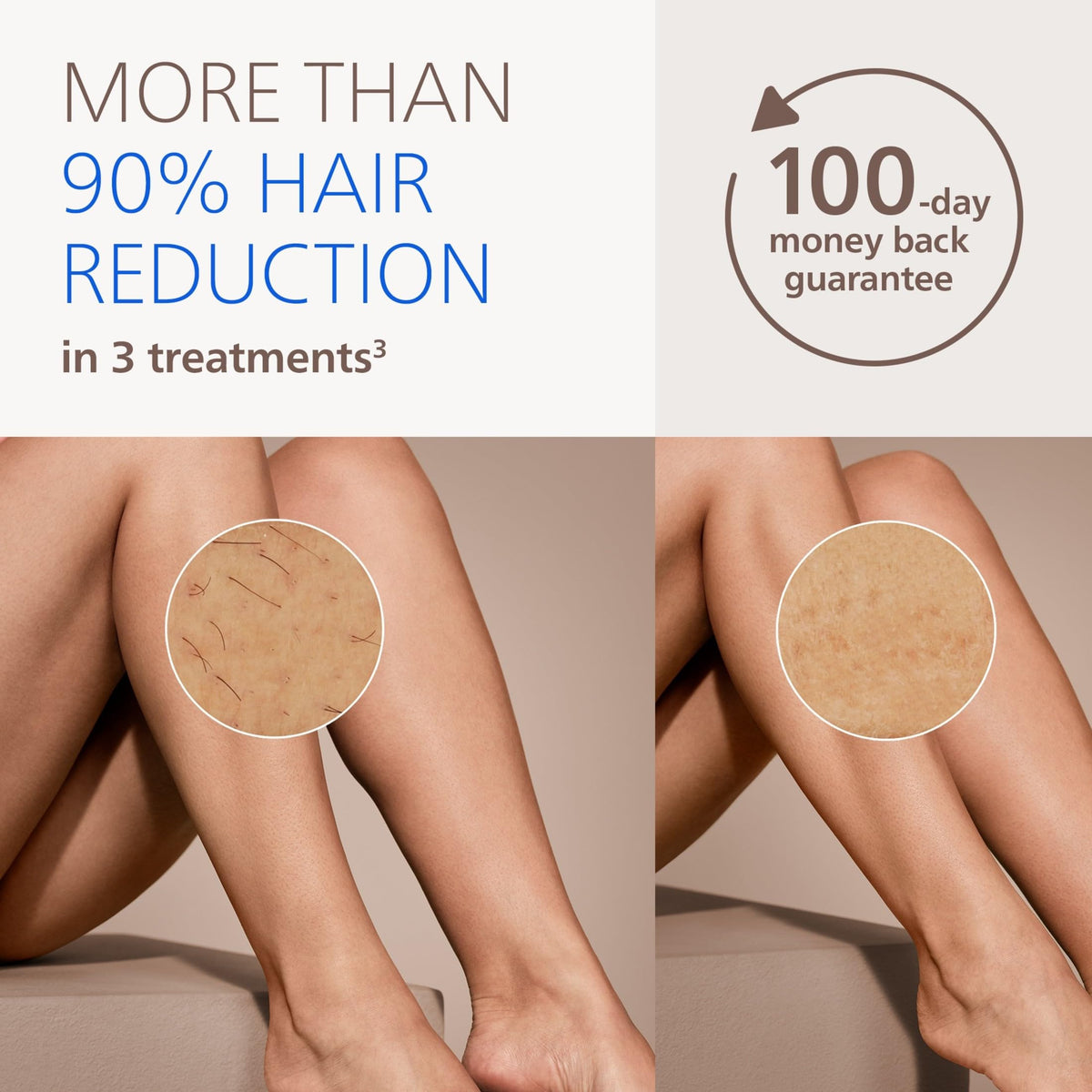 Philips Lumea 8000 IPL Hair Removal Device for Long-Lasting Smooth Skin
