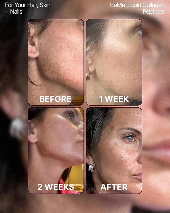 BeMe Glow – VERISOL Marine Collagen, Skin, Hair & Nails, Mixed Berry