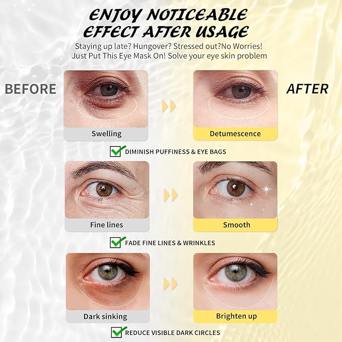 Maskiss Under Eye Patches (30 Pairs), Caffeine Eye Masks for Dark Circles Puffy Eyes Undereye Bags, Collagen Eye Patches for Wrinkles and Puffiness, Skin Care Gift for Her