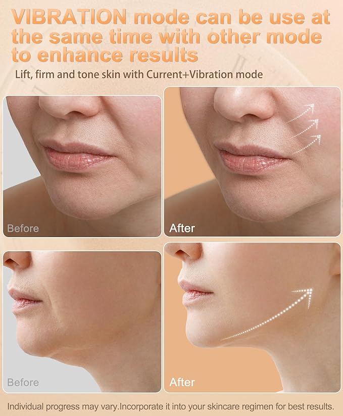 Radio-Frequency Skin Tightening Device | 6 in 1 Home-RF Face Beauty Device | Professional Facial Skin Tightening | Lifting | Wrinkle Reducing | Anti Aging | Depuff | Increase Absorption(with Gel)