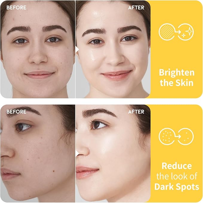 #OOTD Vitamin C Niacinamide Toner for Face, 8.45 fl oz | Korean Skincare