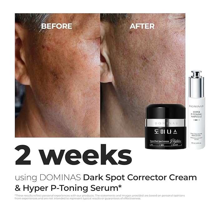 DOMINAS Tranexamic Acid Dark Spot Corrector Cream - Visibly Reduce Age Spots, Sun Spots with TXA, Niacinamide, Bakuchiol, Daily Moisturizer for Uneven Tone & After Spot Care, Korean Skincare, 1.76 oz