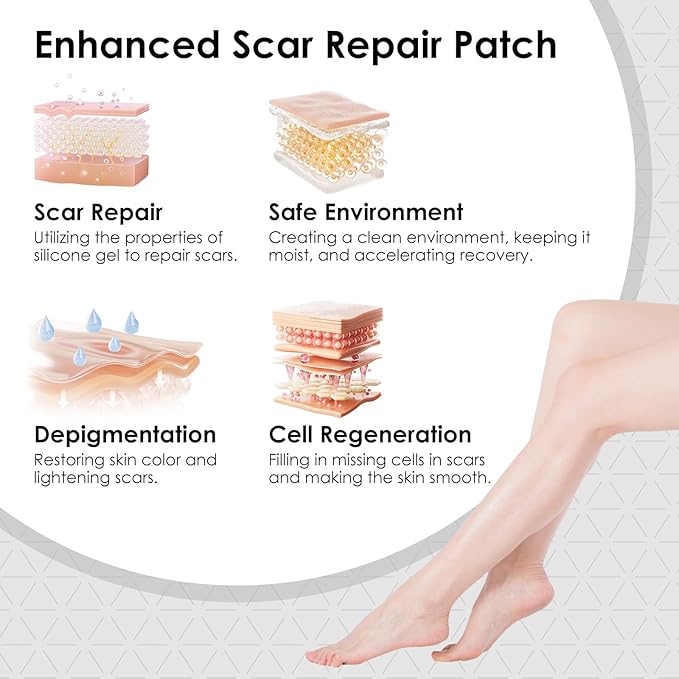 Silicone Scar Sheets,Silicone Scar Tape for Removal Treatment,Medical Grade Scar Tape for Surgical Scars,C-Section,Tummy Tuck,Scar Removal Away(1.6" x 60" Roll - 1.5M) Keloid Bump Removal
