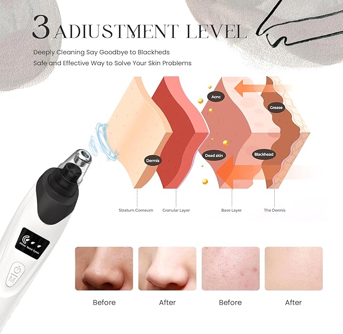 2024 Blackhead Remover Pore Vacuum,Facial Pore Cleaner-5 Suction Power,5 Probes,USB Rechargeable Blackhead Vacuum Kit Electric Acne Extractor Tool for Adult