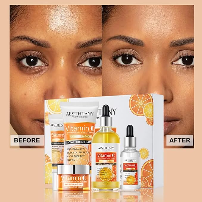 R RadiantRise Vitamin C Skin Care Set For Women, 5-In-1 Moisturizing Hyaluronic Acid Skin Care Routine with Facial Cleanser, Serum, Face Cream, Eye Cream, Toner