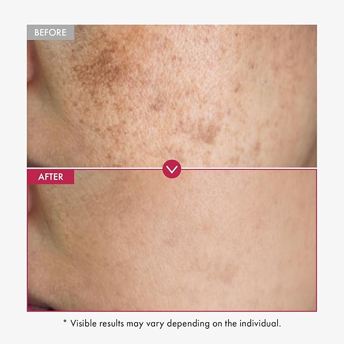 TOSOWOONG Niacinamide 10% + Tranexamic Acid 4% Serum for Radiant Glass Skin