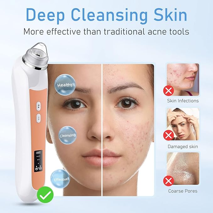 Facial Pore Blackhead Remover Vacuum