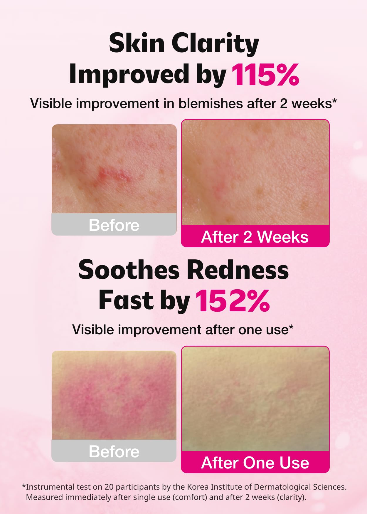 ISOI Blemish Care Up Serum with Arbutin & Rose Otto Oil, 0.85 fl oz