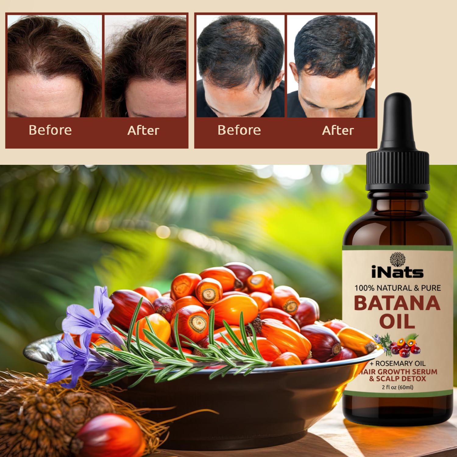 iNats Batana & Rosemary Hair Growth Serum (2 Fl Oz) - Nourish & Detox Scalp for Thicker, Stronger, Longer - Dr. Sebi Recommended, Natural Hair Oil for Women & Men – Intensive Repair & Nourishing