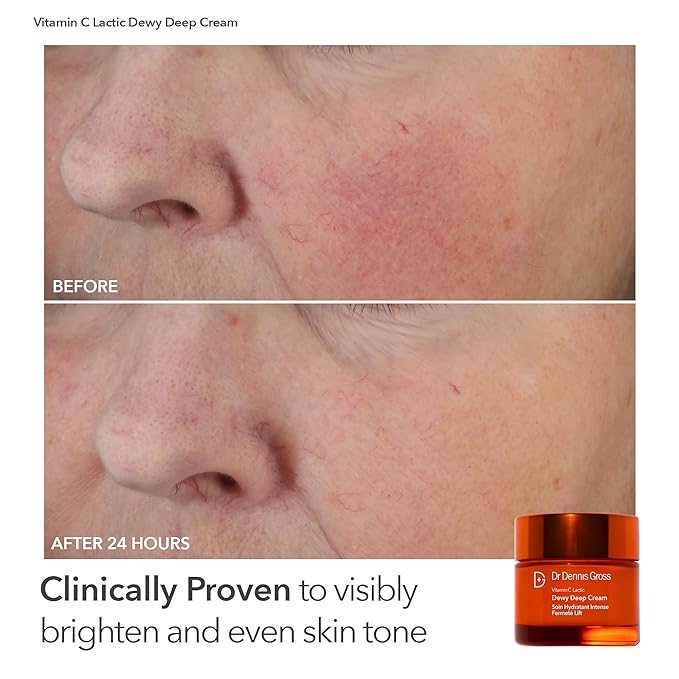 Dr Dennis Gross dpl FaceWare Pro LED Device Boost Collagen, Brighten & Firm Kit – Pink LED Mask, Cleansing Oil, Dewy Deep Cream & 5 Universal Daily Peels | $592 Value Gift Set