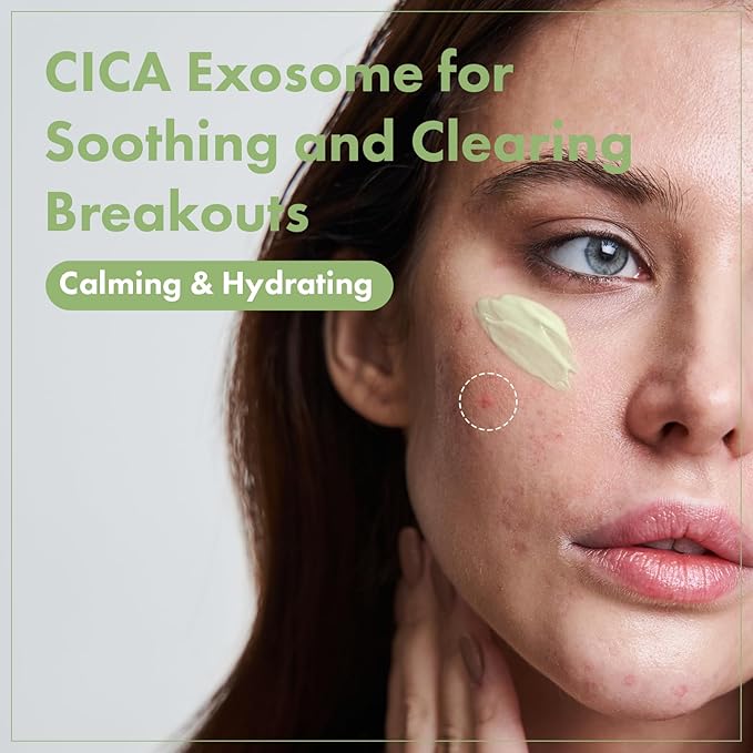 TOSOWOONG Exosome CICA Face Cream for Redness & Blemish-Prone Skin, Calming