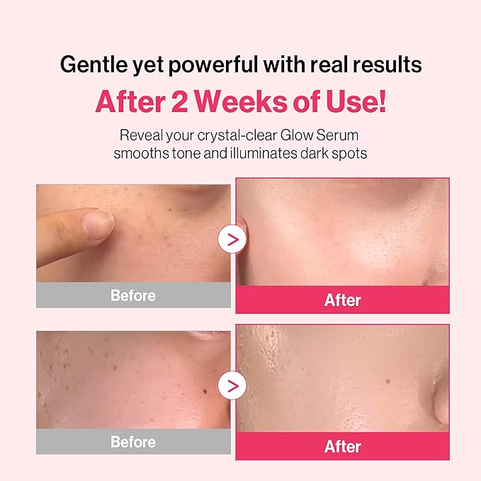 [Redence] Dark Spot Corrector Serum with 5% Niacinamide & Vitamin C | Tone & Spot Ampoule for Uneven Tone & Hydration | Korean Daily Skincare for All Skin Types | 30ml / 1 fl oz