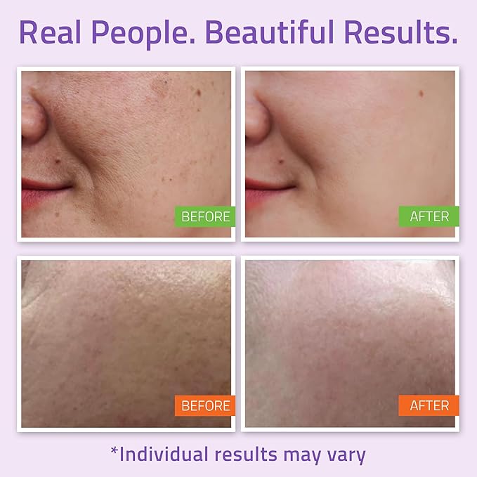 YEOUTH Skin Care Set for Complete Daily Skincare Routine 5-Piece