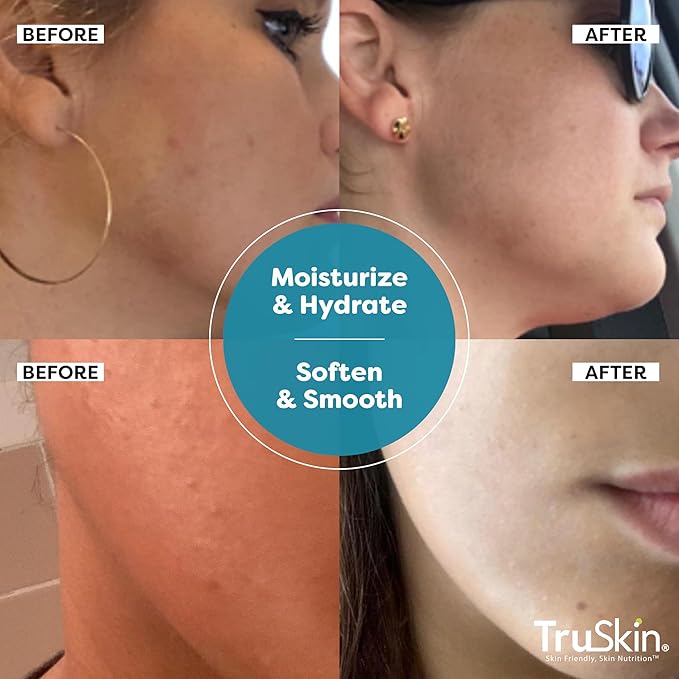 TruSkin Hyaluronic Acid Serum for Face for Hydrated, Plumper Skin, 2 fl oz