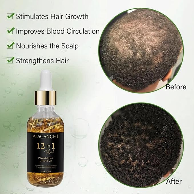 Alaganchi 12-in-1 Hair Growth Oil – Rosemary, Amla & Castor Oil | Strengthens, Nourishes, Reduces Hair Fall | Natural Herbal Blend | Non-Greasy | Paraben & Sulfate-Free