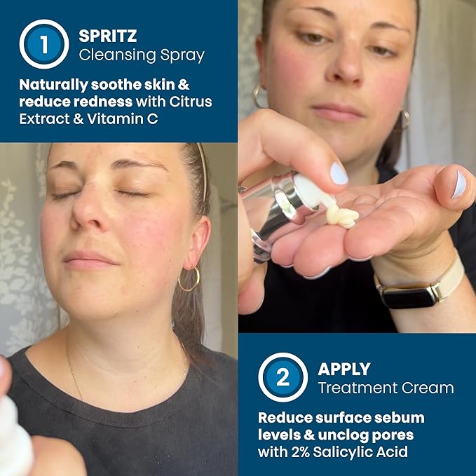ORBE Derma Solutions Orbe it! 2-Step Acne Treatment w/ Salicylic Acid for Face & Body – Helps Unclog Pores & Reduce Pimples, Back Acne, Ingrown Hairs, Razor Bumps, Folliculitis – Spray 1oz & Cream 1oz
