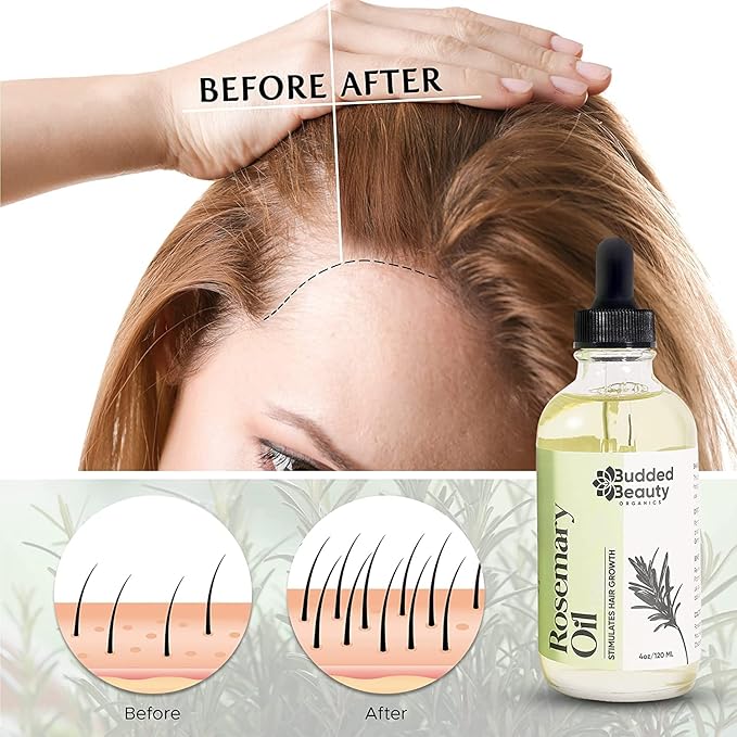BuddedBeauty Organics Natural Rosemary Essential Oil for Hair Growth - Hair Treatment with Dropper Bottle for Women and Men