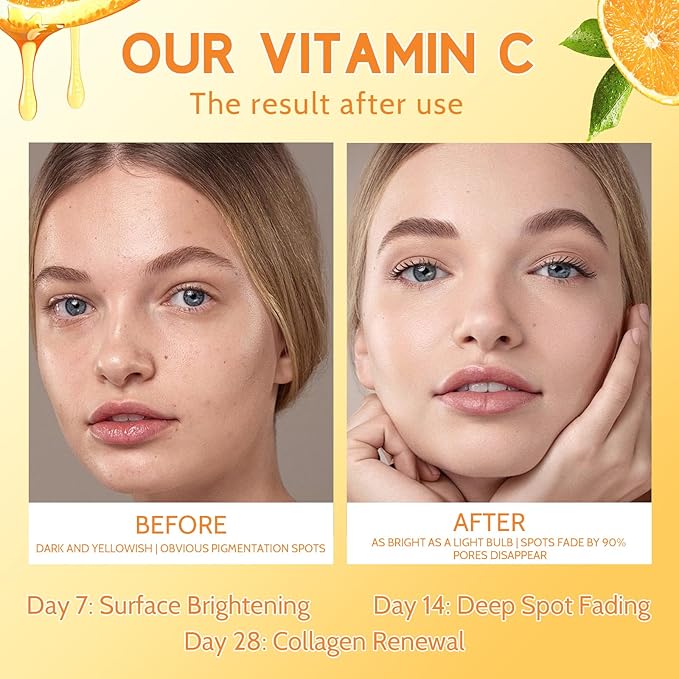 Premium 20% Vitamin C Serum for Face with Vitamin E, Sodium Hyaluronate - Boost Skin Collagen,Hydrate & Plump Skin, Anti Aging & Wrinkle Facial Serum (Scented)