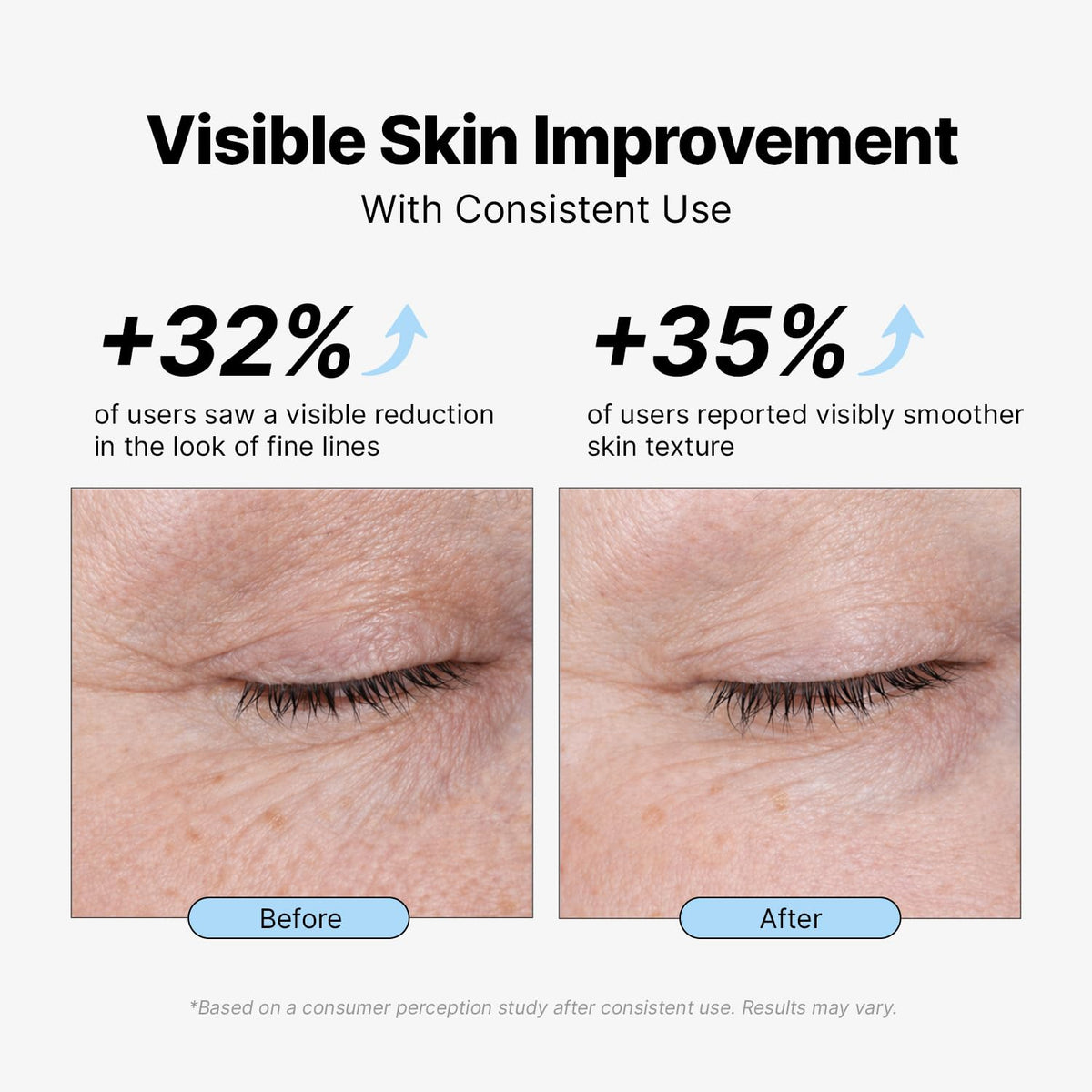 EnaSkin Retinol Collagen Face Cream for Wrinkles, Anti-Aging Moisturizer