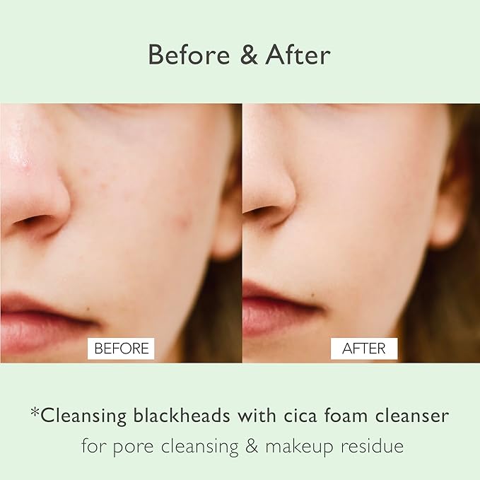 NOWATER Korean Foaming Face Wash with Centella (Cica) – Pore Cleansing Foam Cleanser for Oily & Acne-Prone Skin, Hyaluronic Acid, Aloe Vera & AHA BHA, Daily Gentle Sebum Control, (4.05 fl.oz)