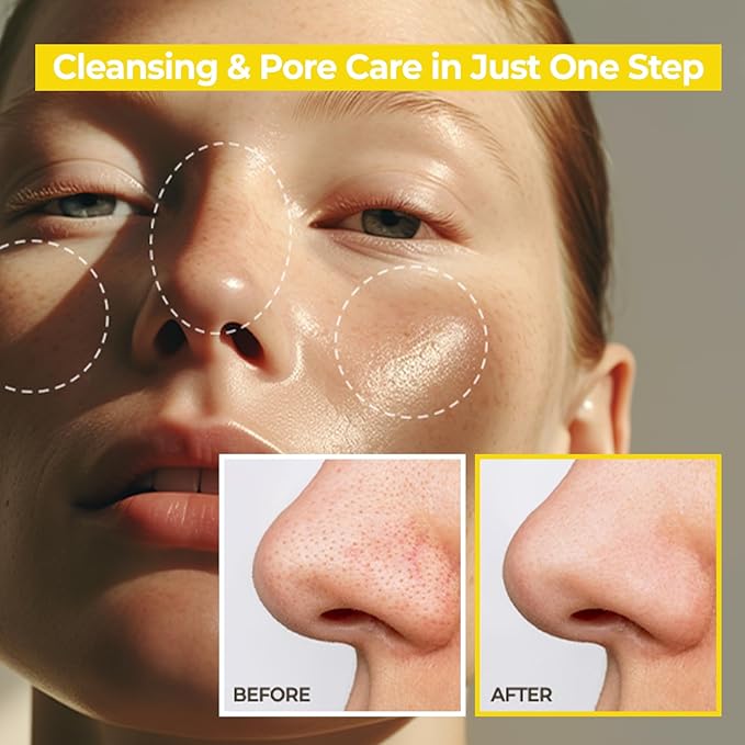 AVCA Jumbo Size Blackhead Remover Cleansing Oil 10.14 fl oz (300ml) – K-Beauty Pore Care Cleanser with PHA, Dissolves Makeup & Sebum, Gentle Exfoliating Oil Cleanser for Oily & Normal Skin