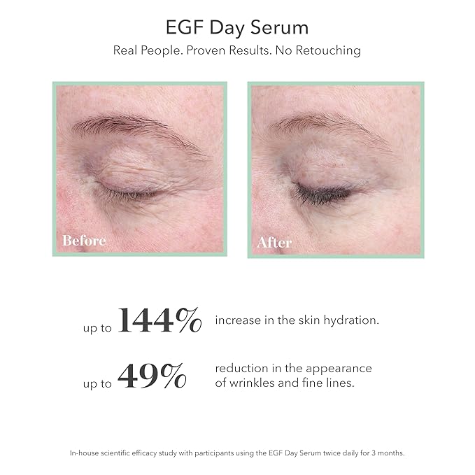 BIOEFFECT EGF Day Serum | Epidermal Growth Factor + Hyaluronic Acid | Age-Defying Face Treatment for Fine Lines & Wrinkles, Hydration & Firmness | Gel Texture, 30 mL / 1.01 oz
