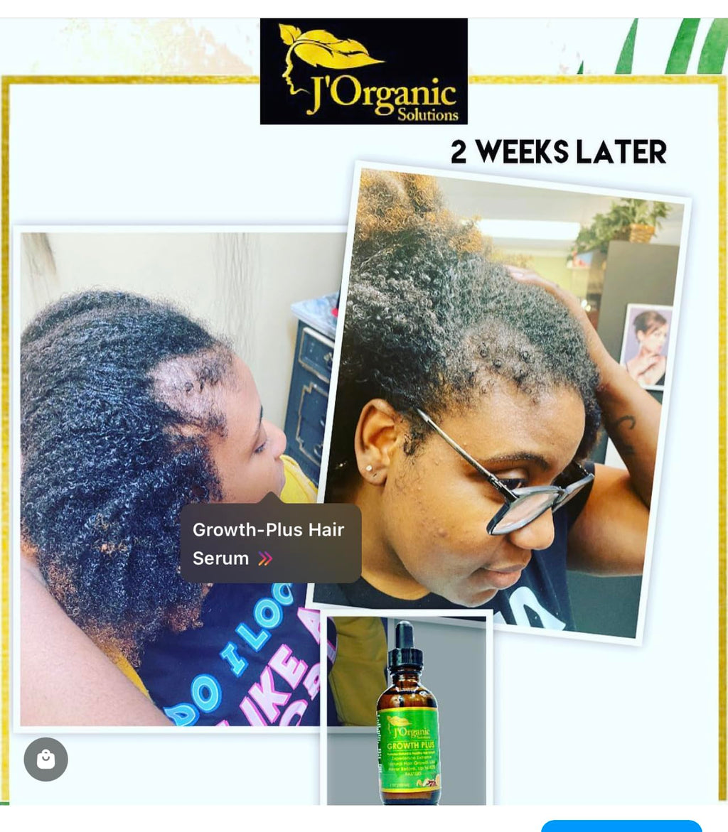 J'Organic Solutions Growth-Plus Scalp Nourishing Oil (4 Oz)