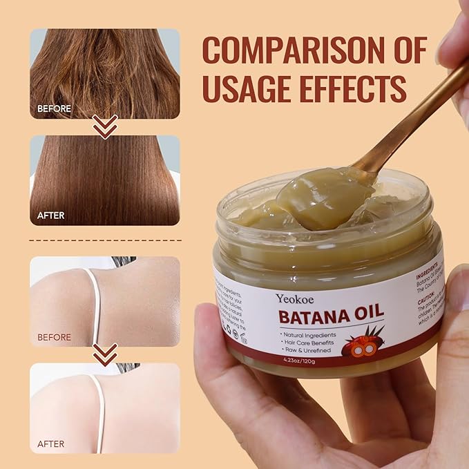 Yeokoe Batana Oil for Hair Growth Pure and Natural Raw Unrefined Dr Sebi,Hair Oil,Great for Skin Care and Hair Care Promotes Hair Thickness for Men Women