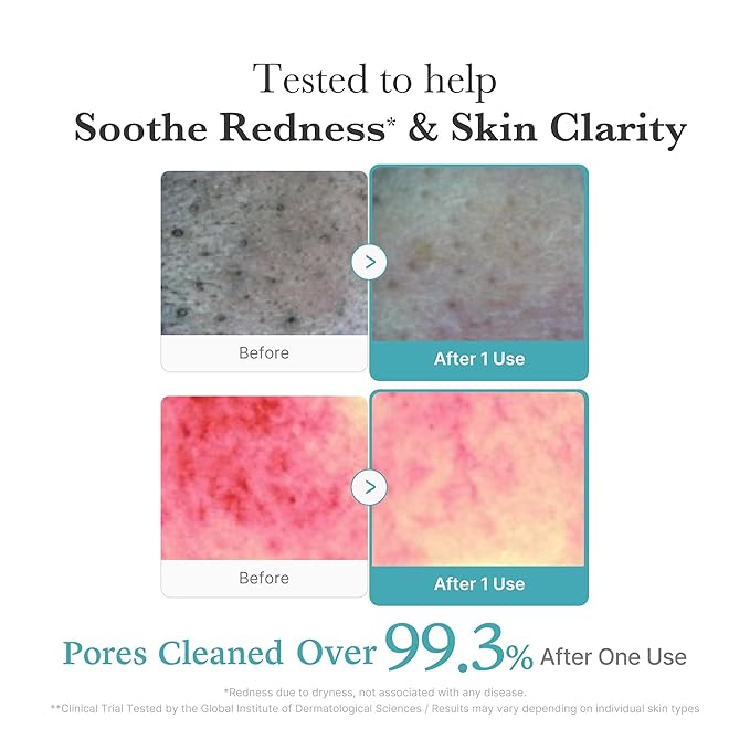 medicube Facial Cleanser Azelaic Acid Whip Cleanser