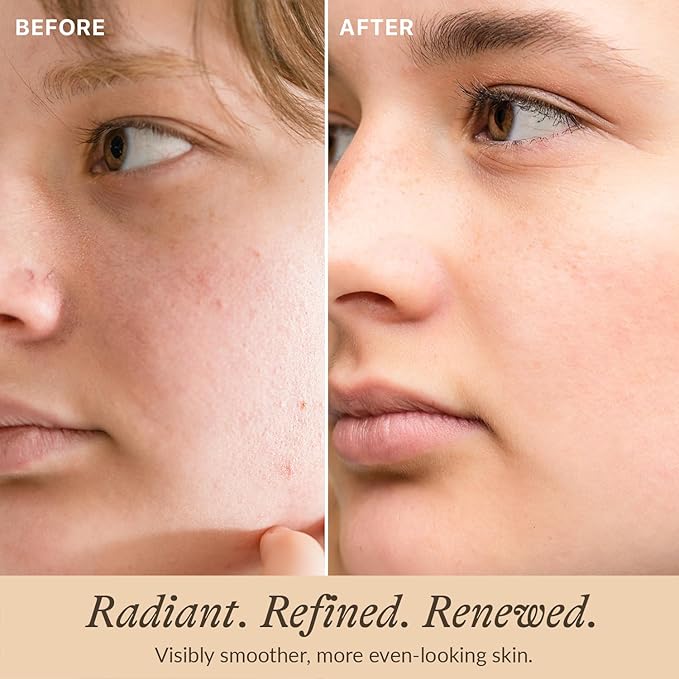 Bio Retinol Alternative Bakuchiol Serum - Smooths Skin & Reduces Fine Lines