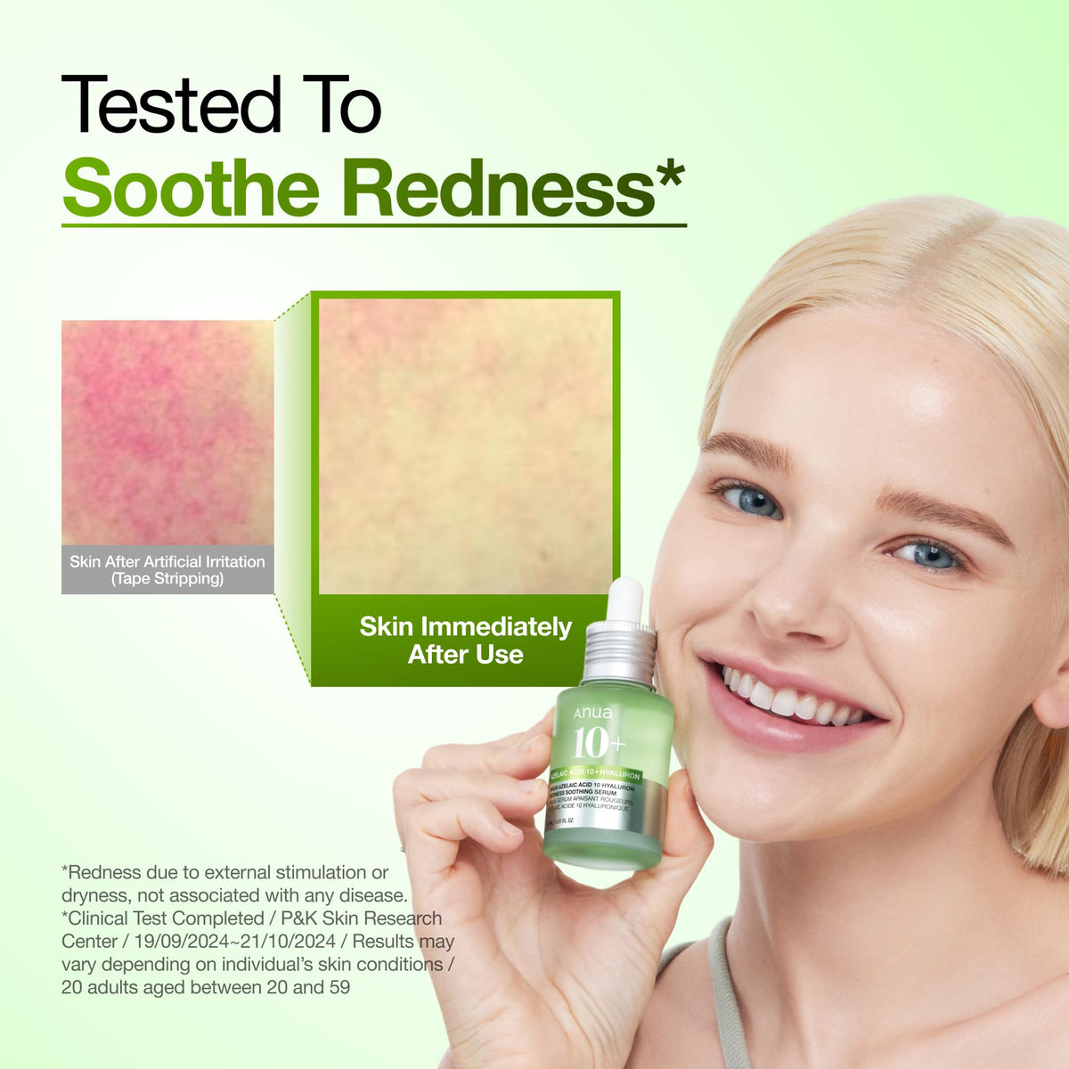 Anua Azelaic Acid 10 Hyaluron Redness Soothing Serum, 1.01 fl oz