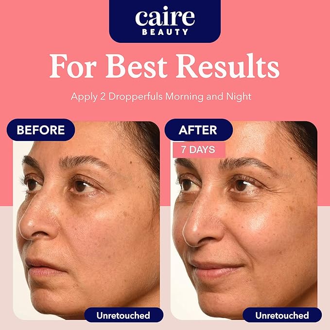 Caire 'Own Your Age' Hyaluronic Acid Collagen Serum, 15ml