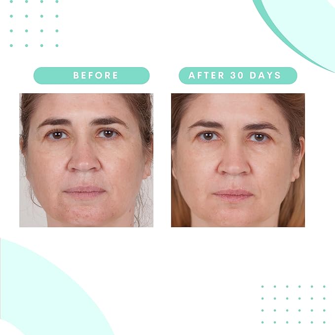 Serious Skincare Glycolic Acid Resurfacing Treatment Pads for Face, Exfoliates & Removes Dulling Dead Skin Cells, Unclogs Pores & Visibly Improves Skin Radiance & Texture, 60 Pre-Soaked Disc (2Pack)