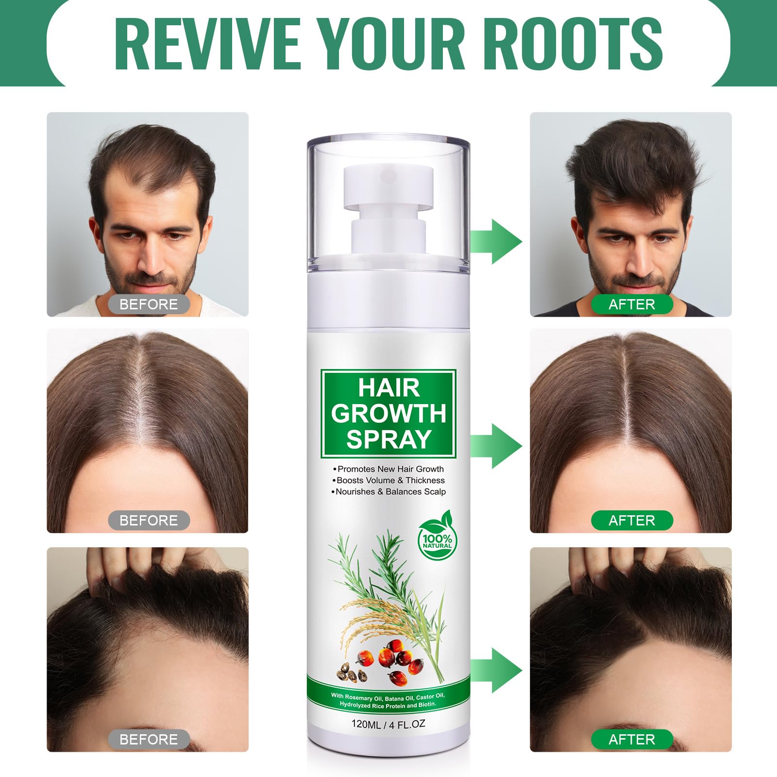 Hair Growth Serum Spray, Natural Hair Growth Spray With Biotin, Batana, Rosemary, and Castor Oil, Caffeine Ginseng Scalp Care Treatment, Thinning Hair Regrowth Thickening for Women Men 4 Fl Oz