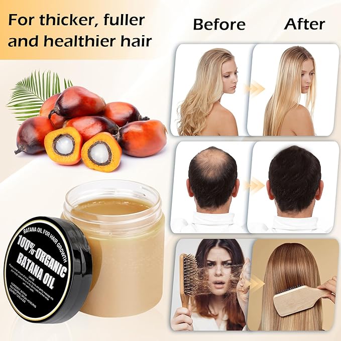 Gzarcwvn 100% Organic Raw Batana Oil for Hair Growth – Natural Treatment for Alopecia, Hair Maintenance, and Nourishment – Moringa & Batana Oil Blend for Smooth, Tangle-Free Hair – 120ml (4.2oz)