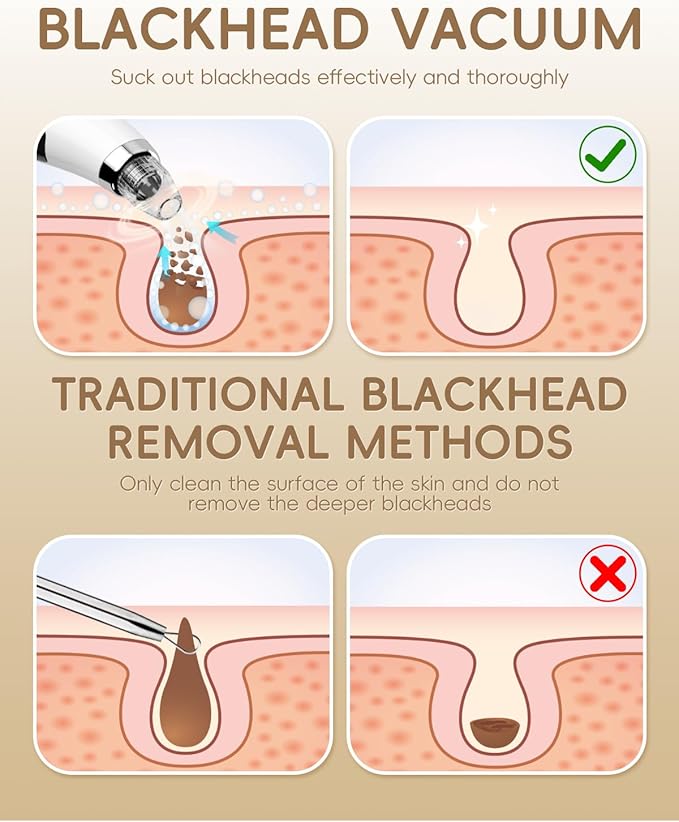 Facial Pore Blackhead Remover Vacuum - Fore Cleaner and Blackhead Extractor with 3 Adjustable Suction Levels - 5 Probes - Pore Vacuum Kit for Women&Men (White)