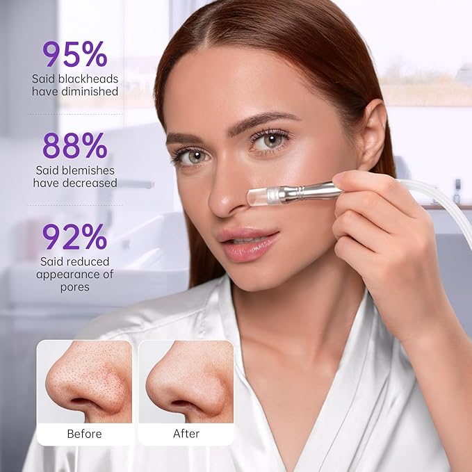 UNOISETION Blackhead Vacuum Removers, 2 in 1 Pro-Grade At-Home Spa Facial Vacuum Pore Cleaner for Blackheads, Whiteheads, Exfoliation, 20-80 Kpa Adjustable Suction for All Skin Types, White