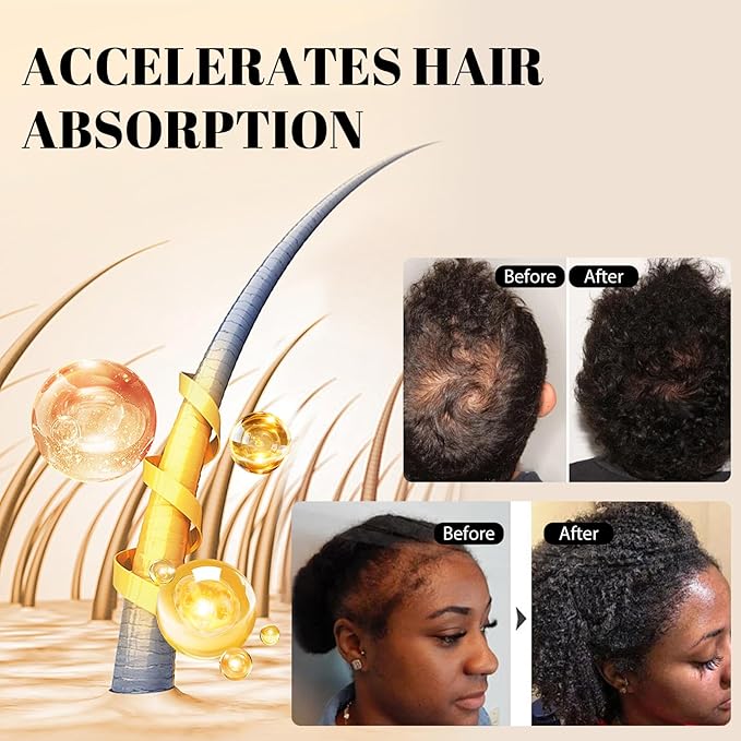 GIOFNA Hair Oil, Rosemary Serum with Bamboo Brush for Frizzy, Damaged Hair Growth Strengthening, Scalp and Argan Care for Women and Men