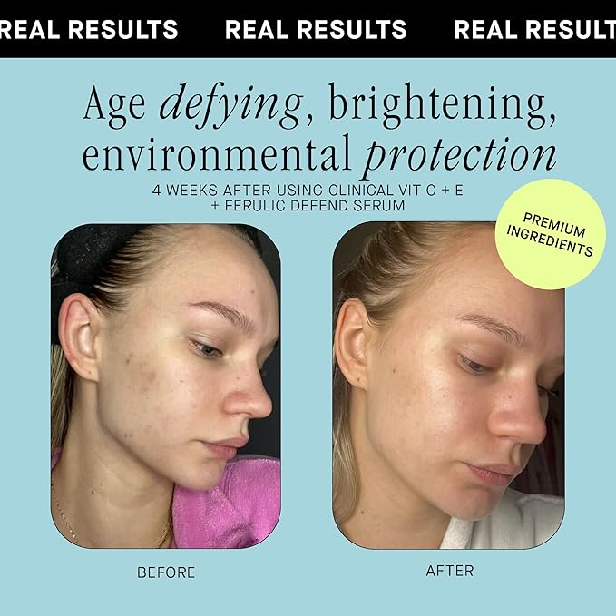 Brandefy Vitamin C Face Serum 15% L. Ascorbic Acid, Ferulic Acid.5% + Vitamin E for Self Care and Beauty, Face Dark Spot Corrector and Anti Aging 1oz, Made In The USA
