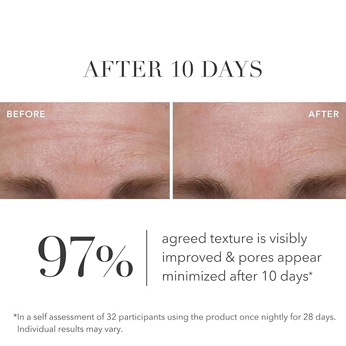 Algenist Green Microalgae Retinol+ Regenerating Serum - Gentle Anti Aging Retinol Face Serum with Time Release Retinol, AHA BHA PHA - Helps Improve Texture, Tone, Pores & Fine Lines (1 oz)