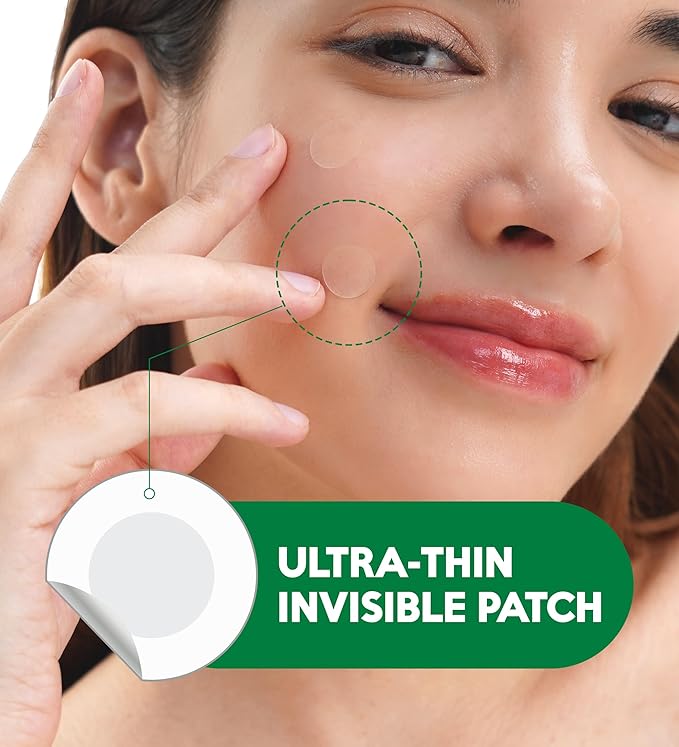 Troubless Invisible Spot Patch EARLY SOS + AFTER CARE (1cm & 1.2cm, 96 EA)