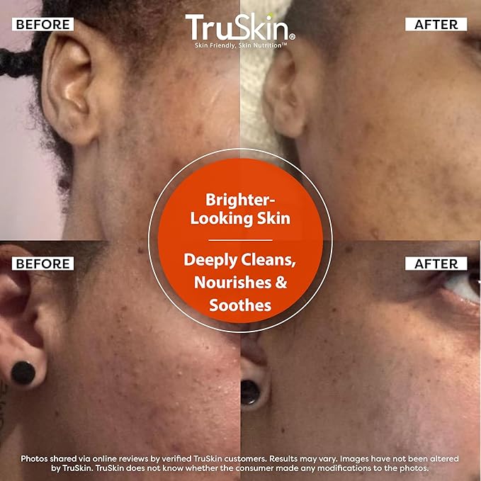 TruSkin Vitamin C Brightening Face Wash with Rosehip Oil, 5 fl oz