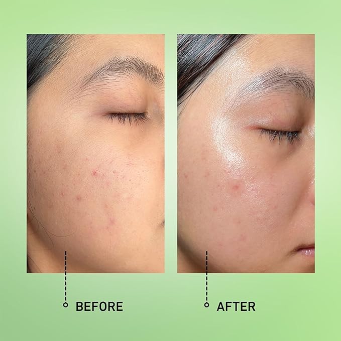 good light Alphabet Oil. Lightweight & Non-Greasy Face Oil with Microbiome Probiotics & Jojoba Oil. Korean Skin Care Probiotic Serum For Face, Neck, & Body. Vitamin C & Vitamin E Oil, 1 Fl. Oz.