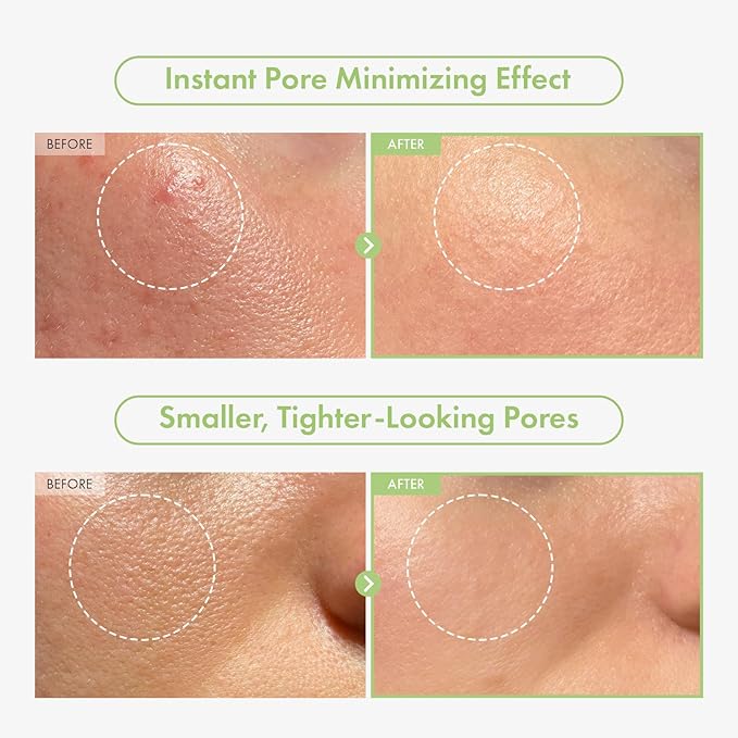TOSOWOONG Green Caviar Pore Ampoule for Pore Care, Firming, Hydrating