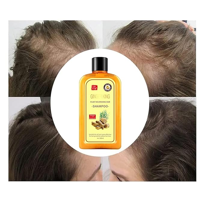 Ginaday Instant Ginger Hair Regrowth Shampoo, Ginger Anti-Fall Shampoo, Ginger Shampoo for Hair Growth, Ginger Hair Care Shampoo, Ginger Anti-Hair Loss Hair Shampoo (yellow 280ML)