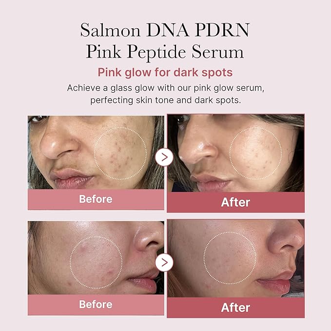 medicube PDRN Pink Peptide Serum with Salmon DNA | Pink Glow Serum with Peptides & Niacinamide for Hydration & Firm-Looking Skin | Uneven Tone Care | Korean Skincare, 1.01 fl. Oz