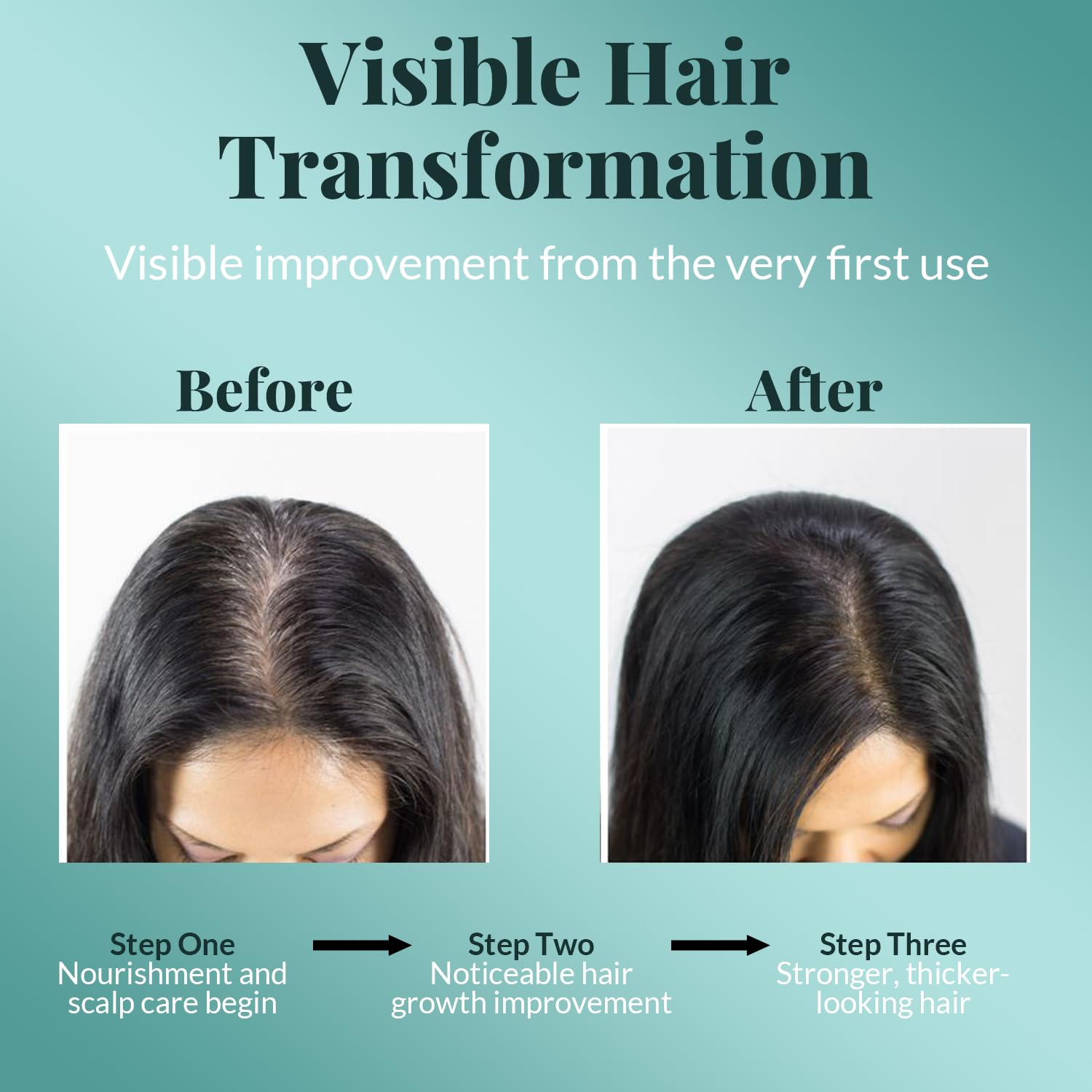AVD ORGANICS Rosemary Oil for Hair Growth & scalp | Infused with Biotin | Hair Strengthening, Nourishing and Volumizing | infused with Jojoba & Castor Oil | NON - GMO 120ml